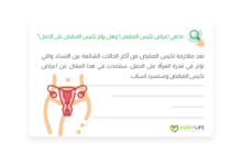 صورة ما هي اعراض تكيس المبايض؟ وهل يؤثر تكيس المبايض على الحمل؟
